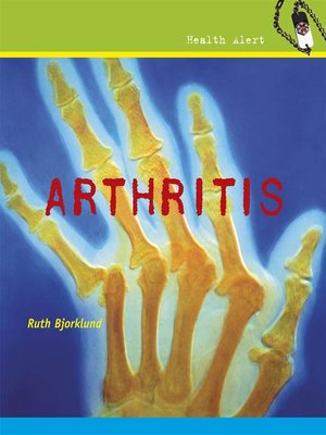 cover image of Arthritis